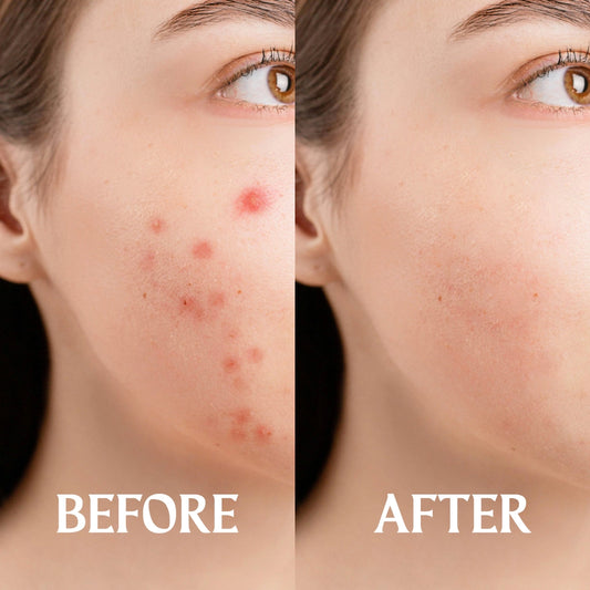 Gentle Methylene Blue Skin Renewal 1% 30mL - Retinol Alternative